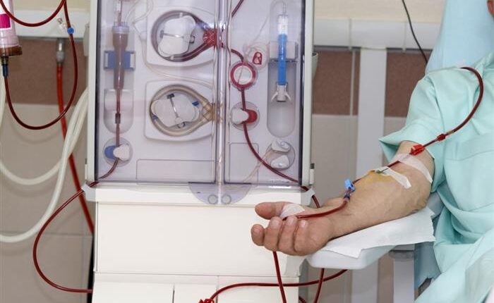 الجنينة.. وفاة جميع مرضى الكلى وحصار يطبق على المدينة