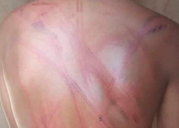 المليشيات تقوم بجلد المواطنين بأبوقوته